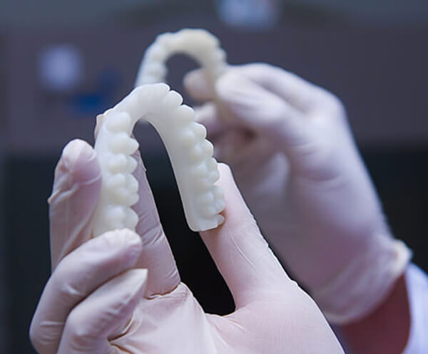 Stampa 3D dentale